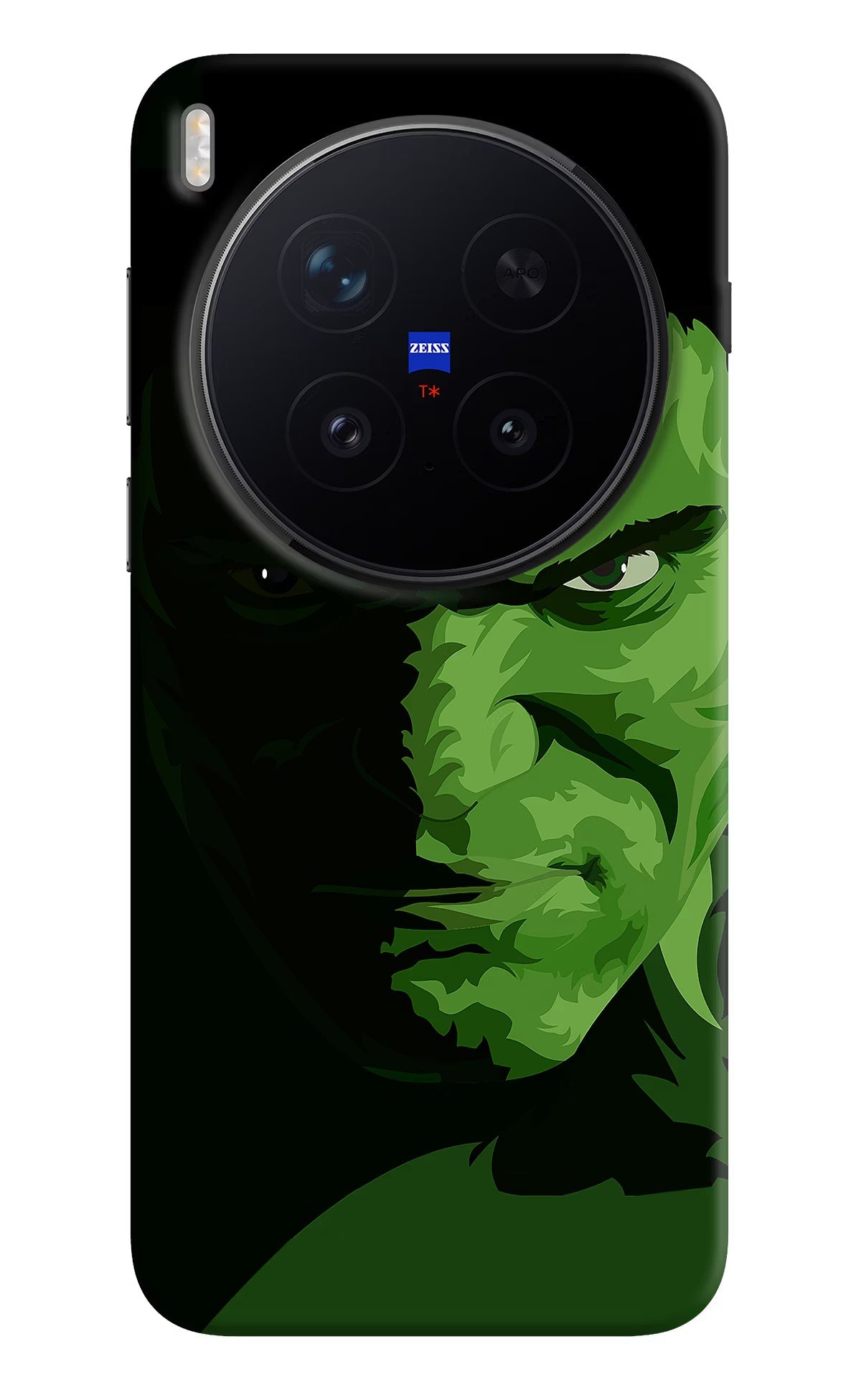 HULK Vivo X300 Pro Back Cover