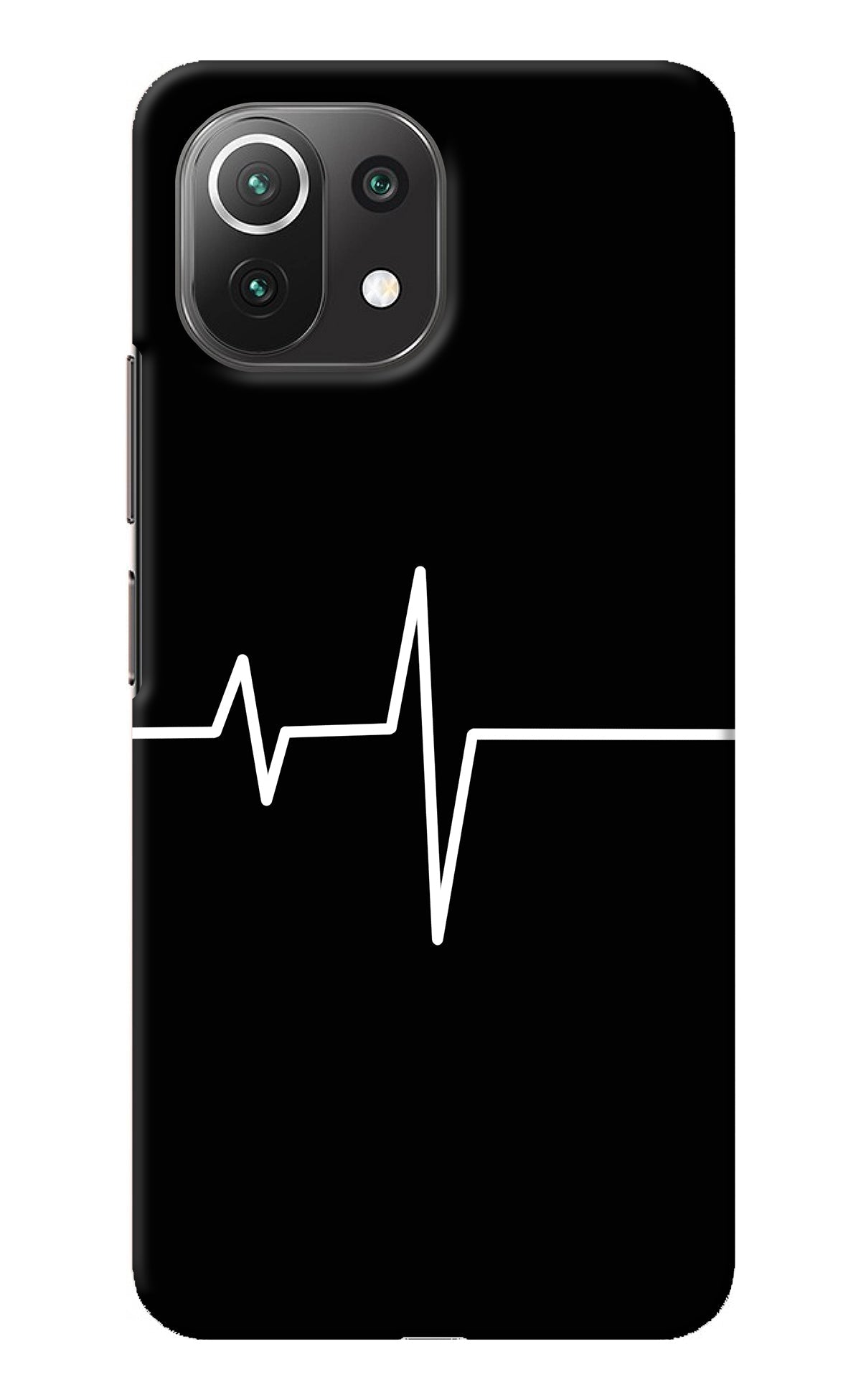 Heart Beats Mi 11 Lite NE 5G Back Cover