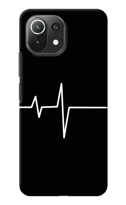 Heart Beats Mi 11 Lite NE 5G Back Cover