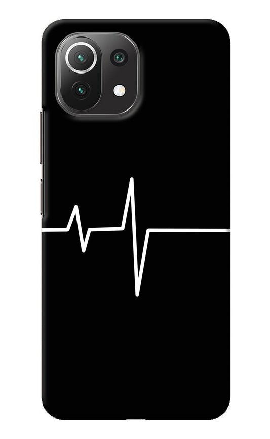 Heart Beats Mi 11 Lite NE 5G Back Cover