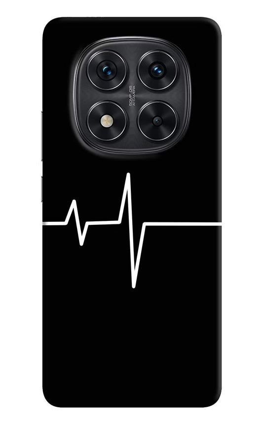 Heart Beats Redmi Note 14 Pro 5G Back Cover