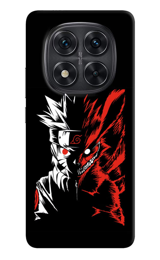 Naruto Two Face Redmi Note 14 Pro 5G Back Cover