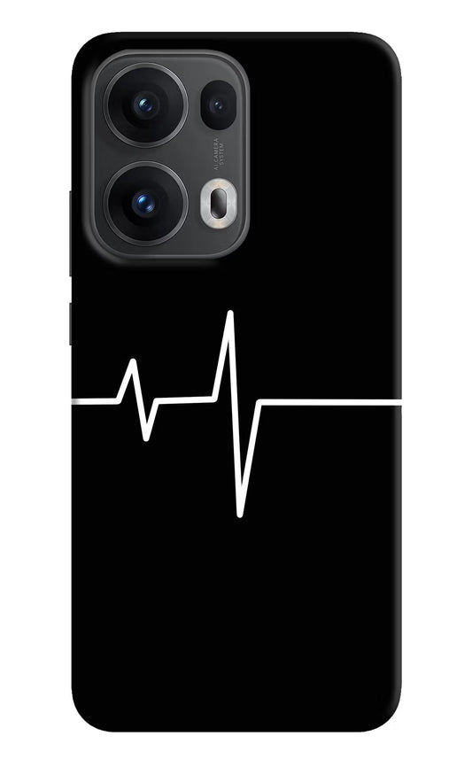 Heart Beats Oppo Reno13 Pro 5G Back Cover