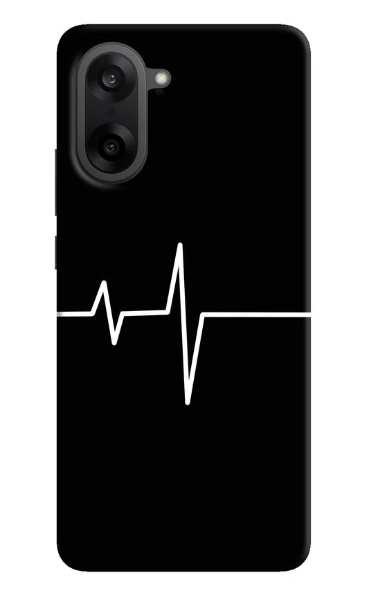 Heart Beats OnePlus Nord CE5 Back Cover