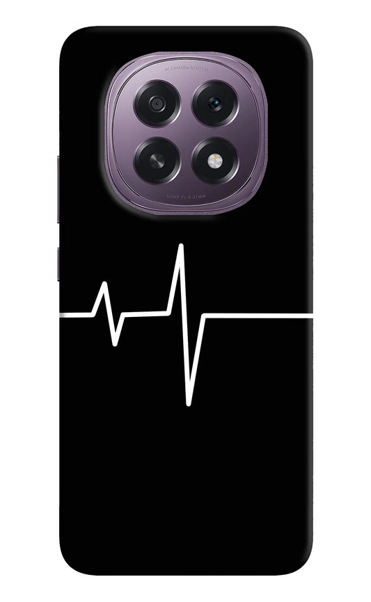 Heart Beats Oppo F29 5G Back Cover