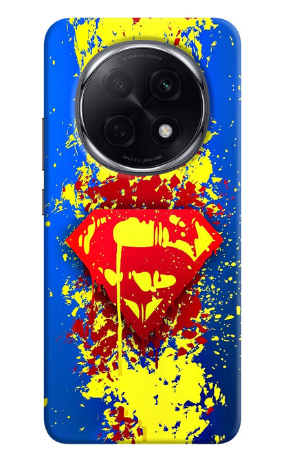 Superman logo Oppo F29 Pro 5G Back Cover