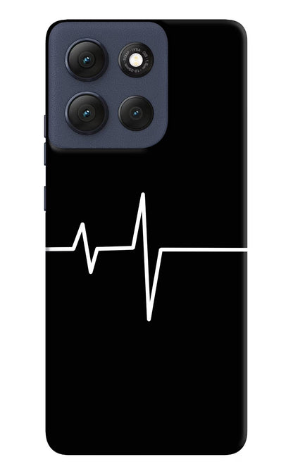 Heart Beats Moto G86 Power Back Cover