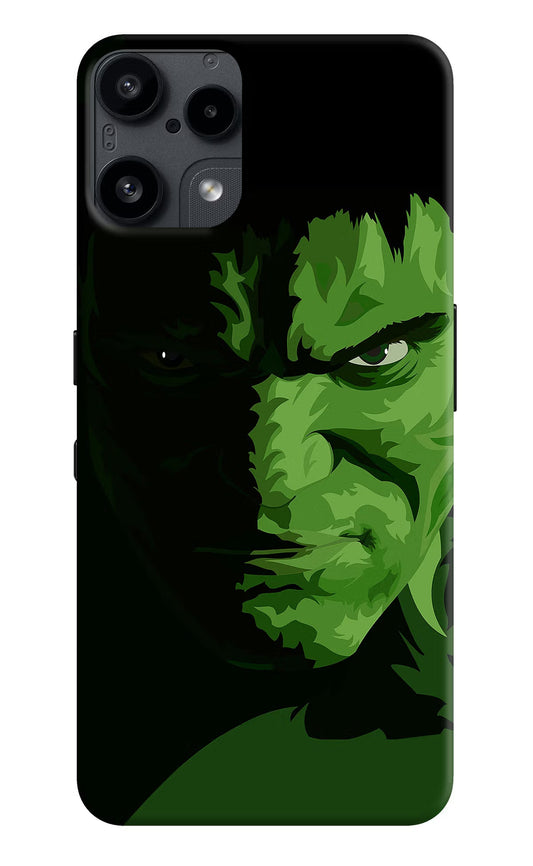 HULK Nothing Phone 3A Lite Back Cover