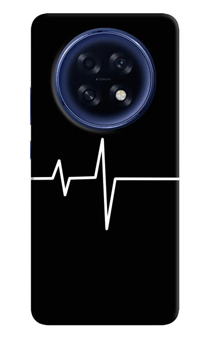 Heart Beats Oppo F31 Pro Plus 5G Back Cover