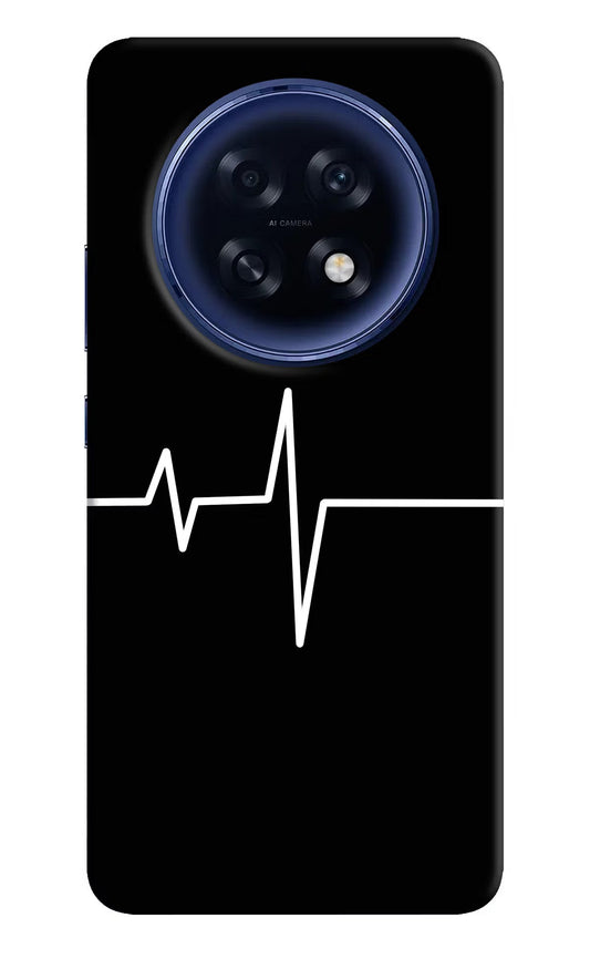 Heart Beats Oppo F31 Pro Plus 5G Back Cover