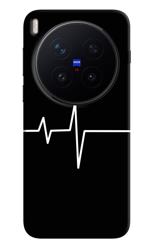Heart Beats Vivo X300 Pro Back Cover
