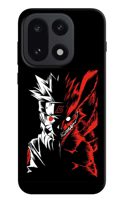 Naruto Two Face OnePlus 15 Back Cover