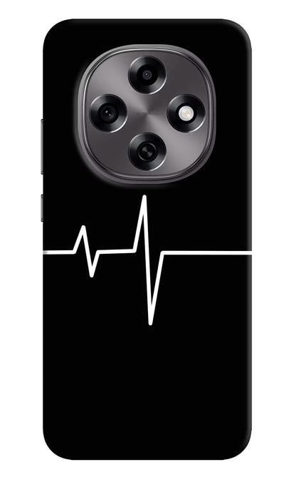 Heart Beats Oppo F31 Pro 5G Back Cover