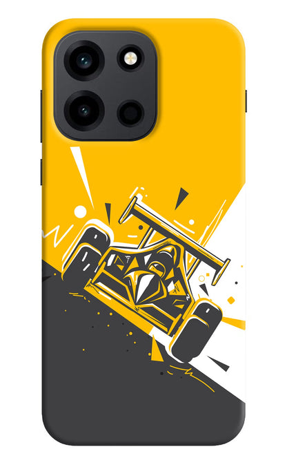 Track King OnePlus Nord 6 Back Cover Hard Case - Hello Swanky