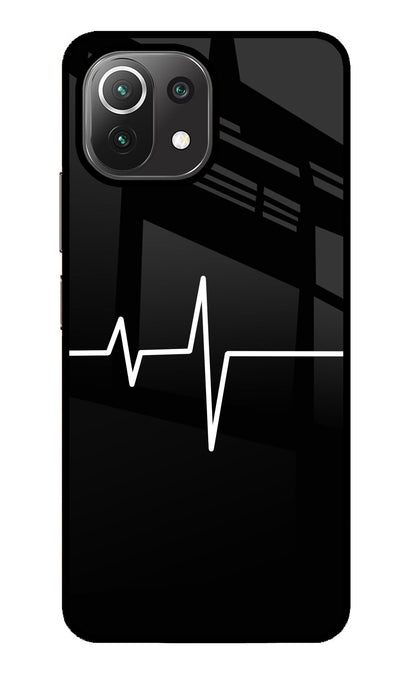 Heart Beats Mi 11 Lite NE 5G Back Cover