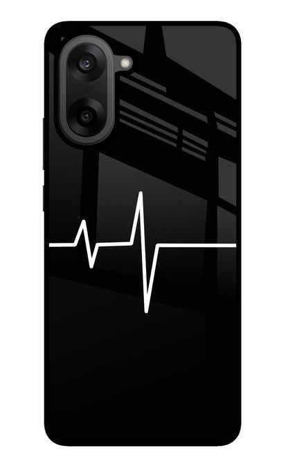 Heart Beats OnePlus Nord CE5 Back Cover